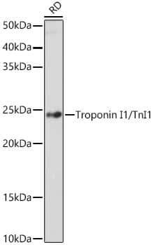 Western Blot: Troponin I Type 1 (slow skeletal) Antibody (5K1U2) [NBP3-16855] - Western blot analysis of extracts of RD cells, using Troponin I Type 1 (slow skeletal) antibody  at 1:1000 dilution.Secondary antibody: HRP Goat Anti-Rabbit IgG (H+L)  at 1:10000 dilution.Lysates/proteins: 25ug per lane.Blocking buffer: 3% nonfat dry milk in TBST.Detection: ECL Enhanced Kit .Exposure time: 180s.