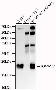 Immunoprecipitation: TOMM22 Antibody (6R1L7) [NBP3-16856] - Immunoprecipitation analysis of 300 ug extracts of K-562 cells using 3 ug TOMM22 antibody . Western blot was performed from the immunoprecipitate using TOMM22 antibody at a dilution of 1:1000.