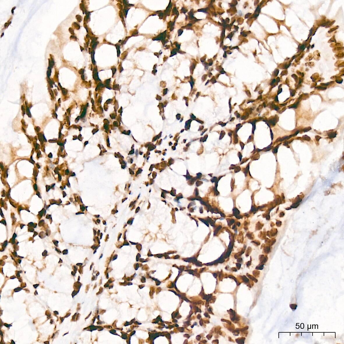 Immunohistochemistry: PIAS2/PIAS1 Antibody (8P1D2) [NBP3-16858] - Immunohistochemistry analysis of PIAS2/PIAS1 in paraffin-embedded mouse colon tissue using PIAS2/PIAS1 Rabbit mAb  at a dilution of 1:200 (40x lens). High pressure antigen retrieval was performed with 0.01 M Tris-EDTA buffer (pH 9.0) prior to IHC staining.