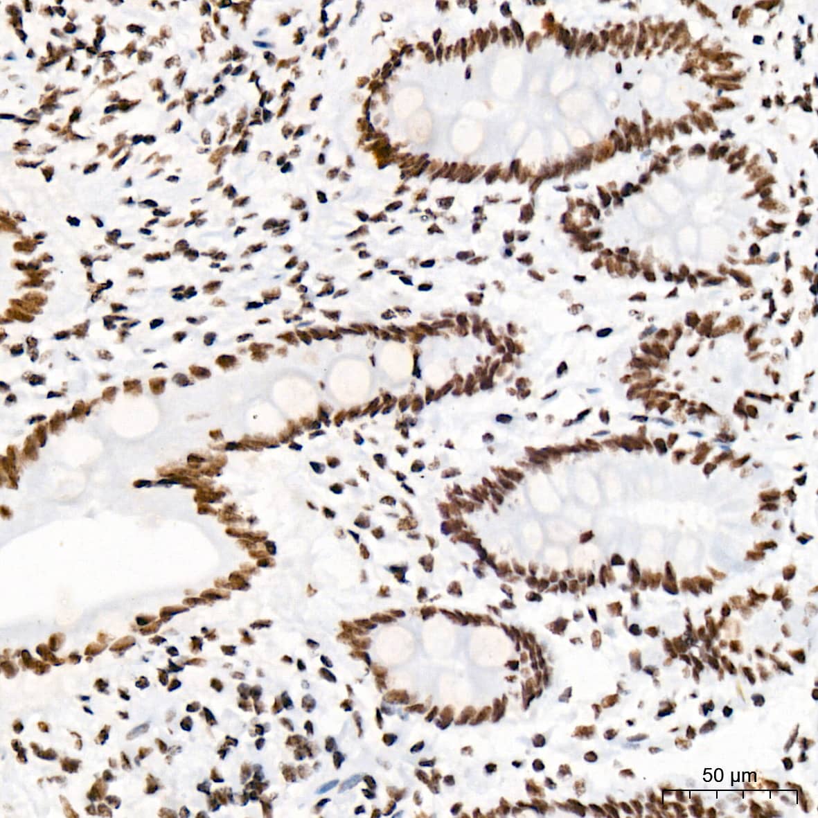 Immunohistochemistry: PIAS2/PIAS1 Antibody (8P1D2) [NBP3-16858] - Immunohistochemistry analysis of PIAS2/PIAS1 in paraffin-embedded human colon tissue using PIAS2/PIAS1 Rabbit mAb  at a dilution of 1:200 (40x lens). High pressure antigen retrieval was performed with 0.01 M Tris-EDTA buffer (pH 9.0) prior to IHC staining.