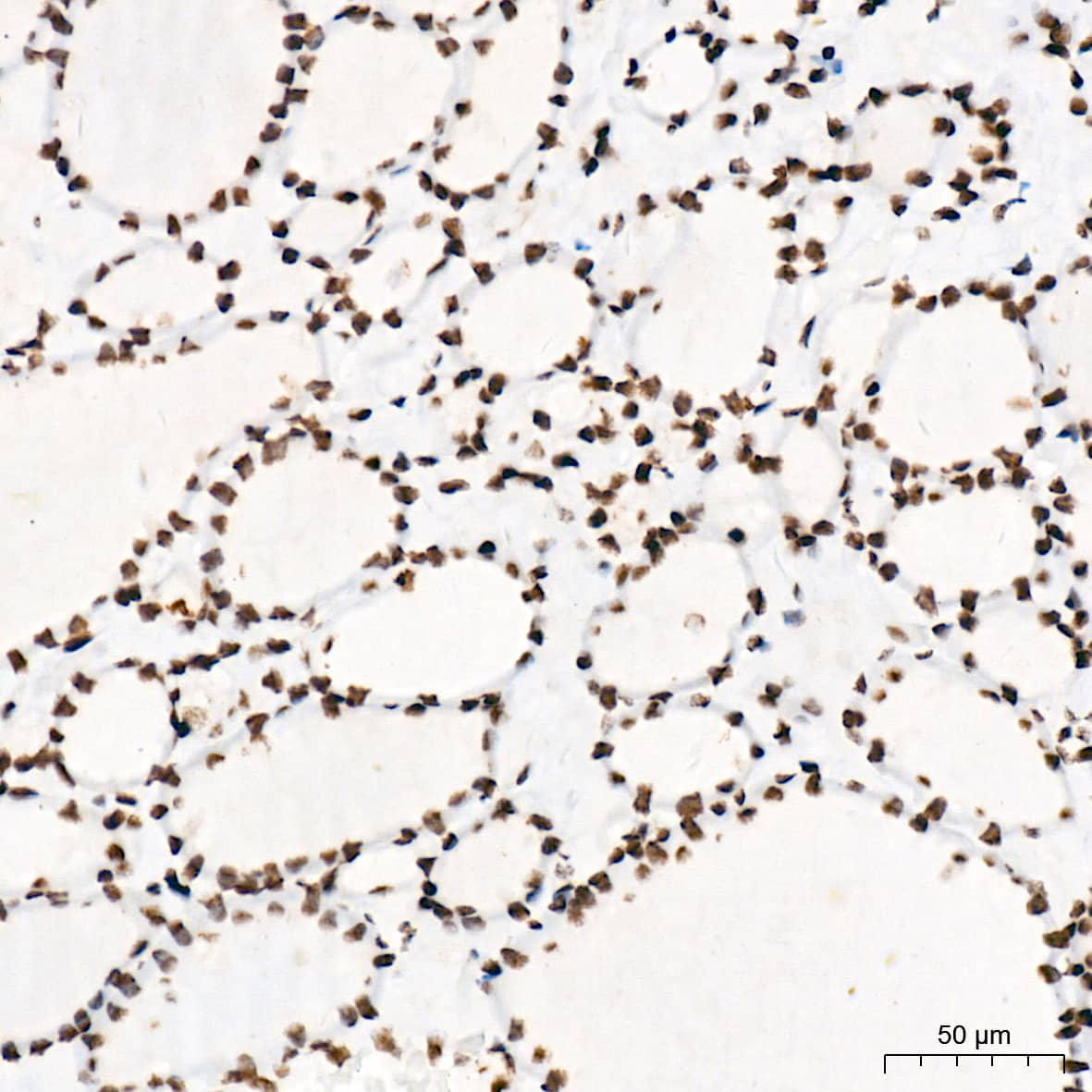 Immunohistochemistry PIAS2/PIAS1 Antibody (8P1D2)