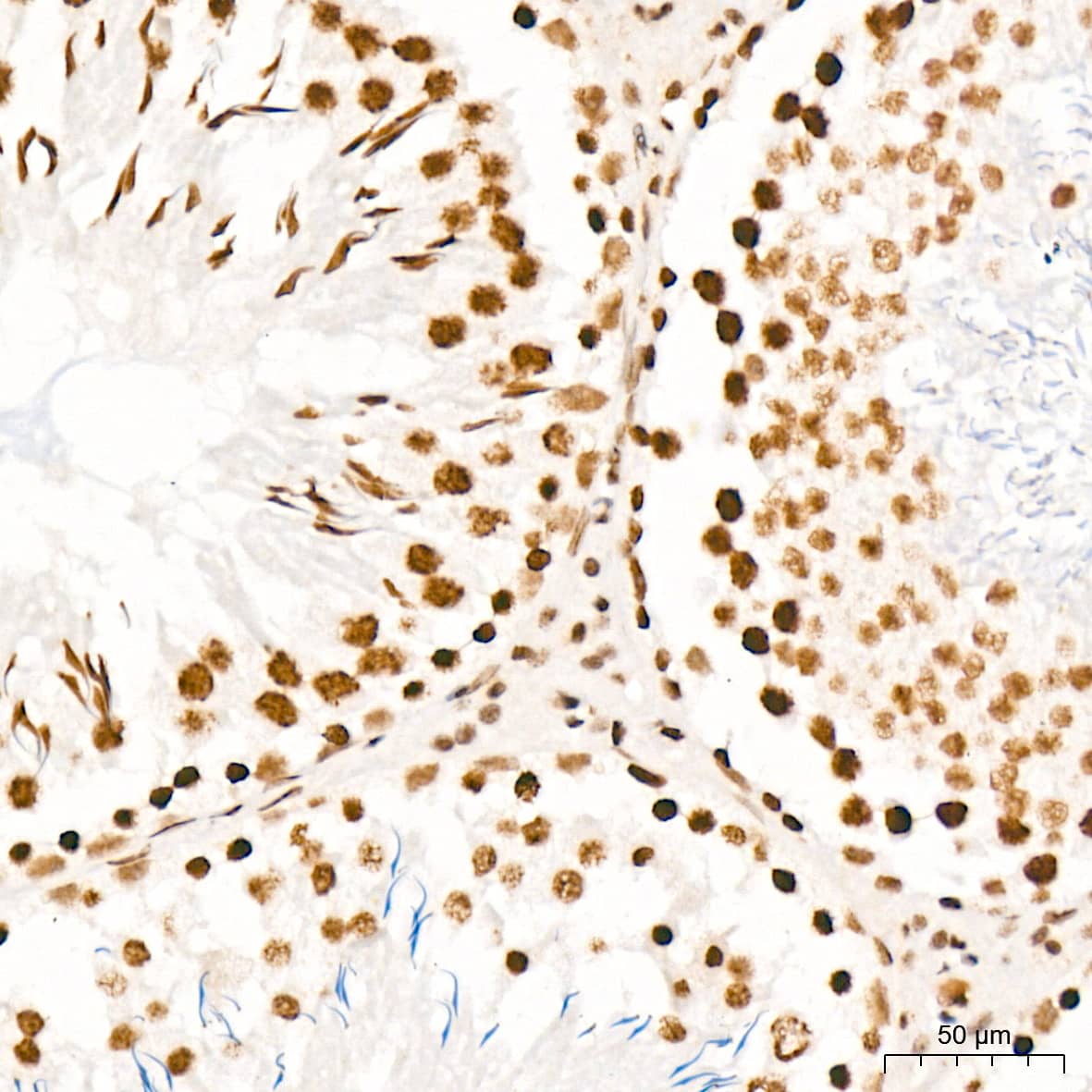 Immunohistochemistry: PIAS2/PIAS1 Antibody (8P1D2) [NBP3-16858] - Immunohistochemistry analysis of PIAS2/PIAS1 in paraffin-embedded rat testis tissue using PIAS2/PIAS1 Rabbit mAb  at a dilution of 1:200 (40x lens). High pressure antigen retrieval was performed with 0.01 M Tris-EDTA buffer (pH 9.0) prior to IHC staining.