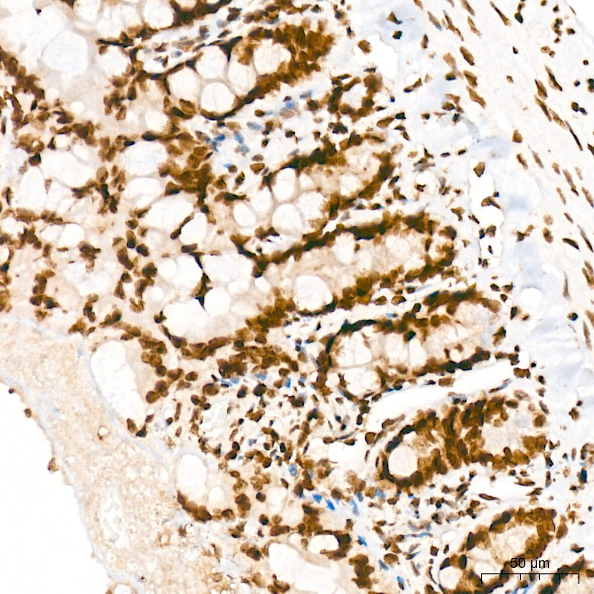 Immunohistochemistry: PIAS2/PIAS1 Antibody (8P1D2) [NBP3-16858] - Immunohistochemistry analysis of PIAS2/PIAS1 in paraffin-embedded rat colon tissue using PIAS2/PIAS1 Rabbit mAb  at a dilution of 1:200 (40x lens). High pressure antigen retrieval was performed with 0.01 M Tris-EDTA buffer (pH 9.0) prior to IHC staining.