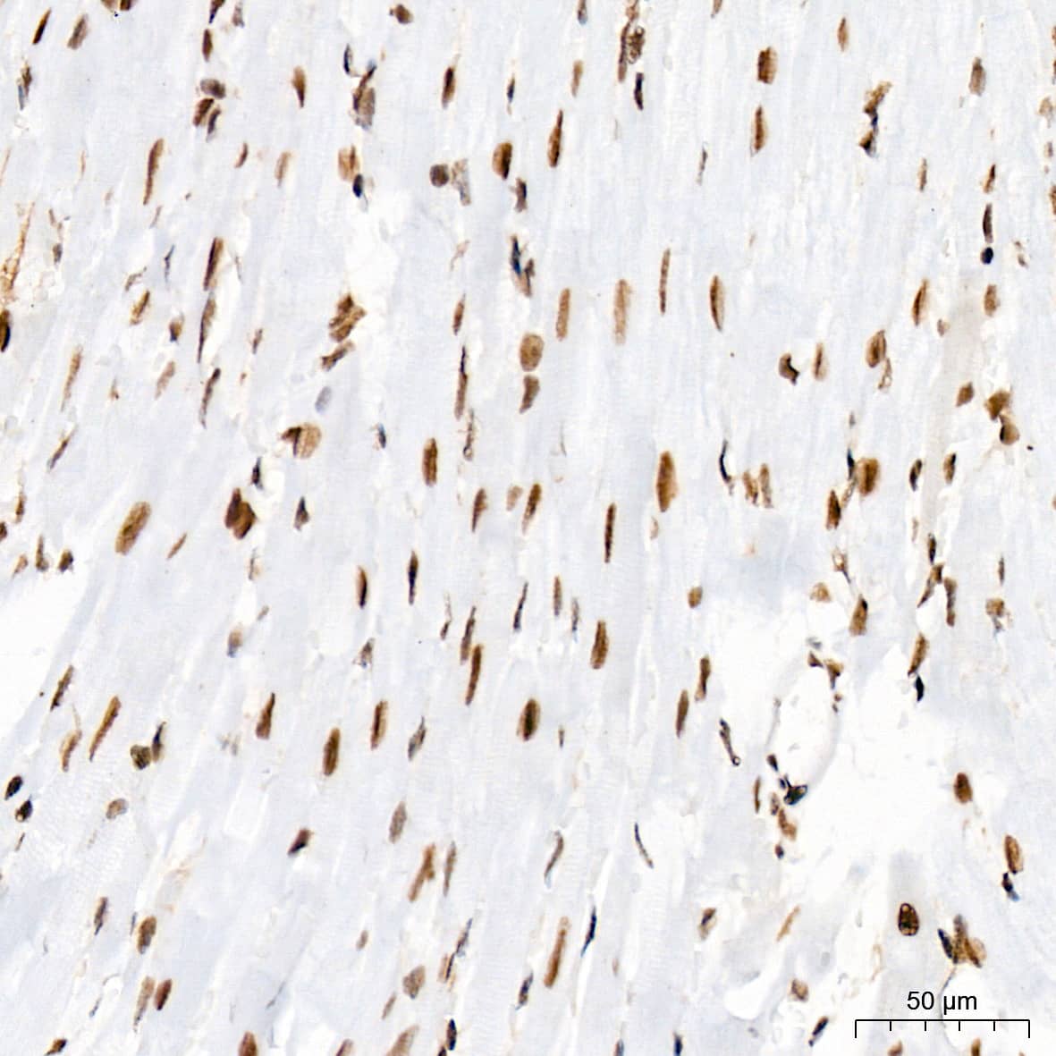 Immunohistochemistry PIAS2/PIAS1 Antibody (8P1D2)