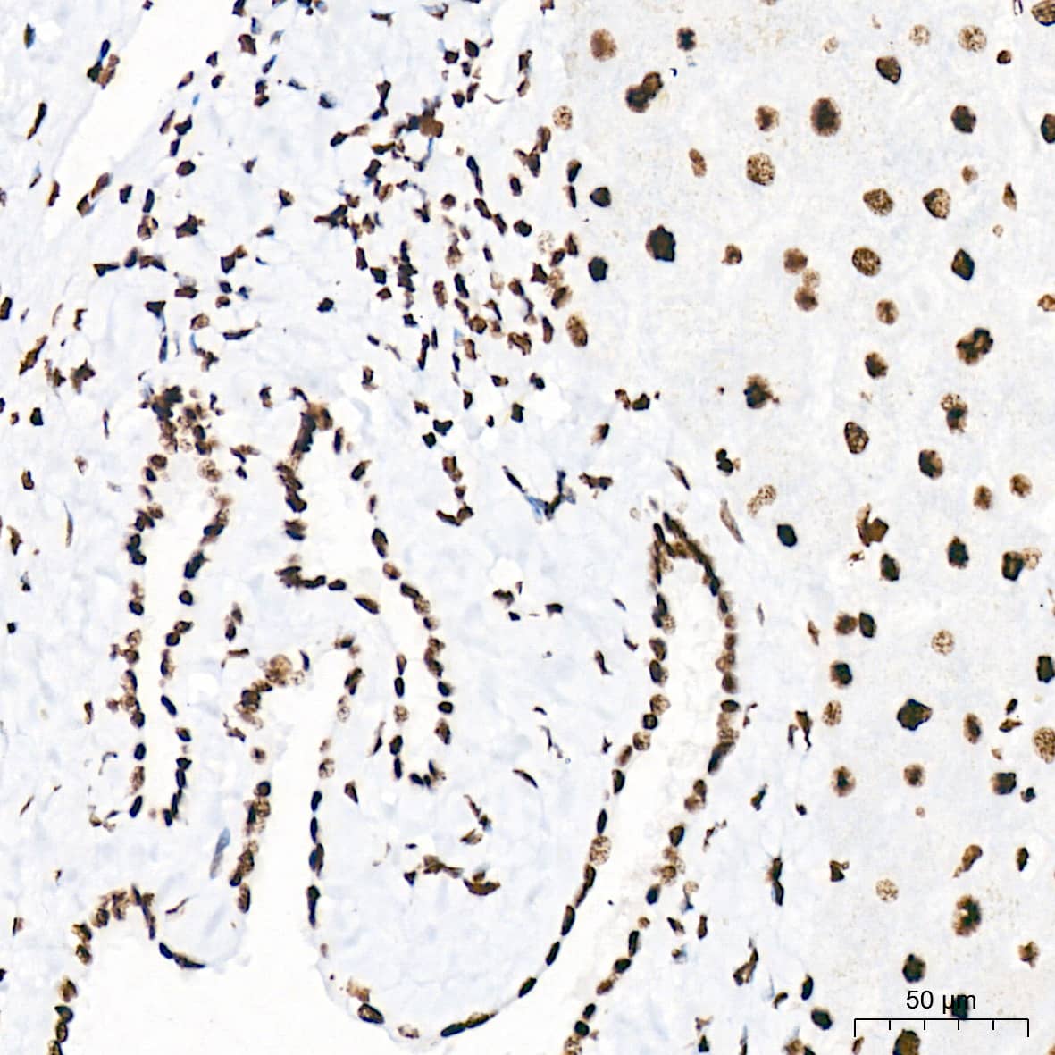 Immunohistochemistry: PIAS2/PIAS1 Antibody (8P1D2) [NBP3-16858] - Immunohistochemistry analysis of PIAS2/PIAS1 in paraffin-embedded human liver tissue using PIAS2/PIAS1 Rabbit mAb  at a dilution of 1:200 (40x lens). High pressure antigen retrieval was performed with 0.01 M Tris-EDTA buffer (pH 9.0) prior to IHC staining.