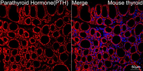 Immunocytochemistry/ Immunofluorescence: PTH Antibody (5X6R6) [NBP3-16862] - Confocal imaging of paraffin-embedded Mouse thyroid tissue using PTH Rabbit mAb followed by a further incubation with Cy3 Goat Anti-Rabbit IgG (H+L) . DAPI was used for nuclear staining (Blue). Objective: 40x. Perform high pressure antigen retrieval with 0.01 M citrate buffer (pH 6.0) prior to IF staining.