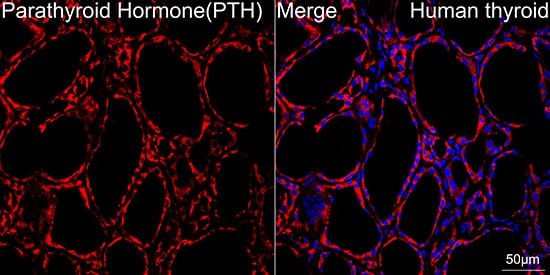 Immunocytochemistry/ Immunofluorescence: PTH Antibody (5X6R6) [NBP3-16862] - Confocal imaging of paraffin-embedded Human thyroid tissue using PTH Rabbit mAb followed by a further incubation with Cy3 Goat Anti-Rabbit IgG (H+L) . DAPI was used for nuclear staining (Blue). Objective: 40x. Perform high pressure antigen retrieval with 0.01 M citrate buffer (pH 6.0) prior to IF staining.