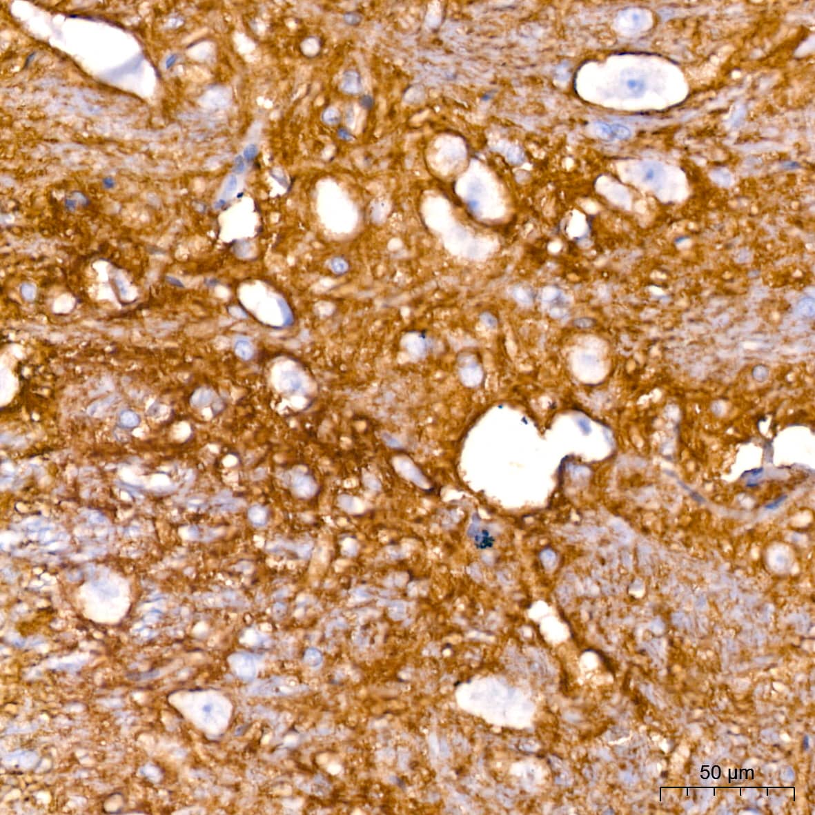 Immunohistochemistry: EAAT1/GLAST-1/SLC1A3 Antibody (7Y4U5) [NBP3-16865] - Immunohistochemistry analysis of paraffin-embedded Rat brain tissue using EAAT1/GLAST-1/SLC1A3 Rabbit mAb at a dilution of 1:200 (40x lens). High pressure antigen retrieval performed with 0.01M Citrate Bufferr (pH 6.0) prior to IHC staining.