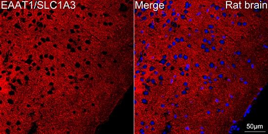 Immunocytochemistry/ Immunofluorescence: EAAT1/GLAST-1/SLC1A3 Antibody (7Y4U5) [NBP3-16865] - Confocal imaging of paraffin-embedded Rat brain tissue using EAAT1/GLAST-1/SLC1A3 Rabbit mAb followed by a further incubation with Cy3 Goat Anti-Rabbit IgG (H+L) . DAPI was used for nuclear staining (Blue). Objective: 40x. Perform microwave antigen retrieval with 0.01 M citrate buffer (pH 6.0) prior to IF staining.