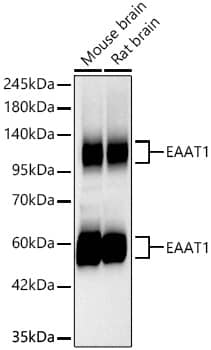 Western Blot: EAAT1/GLAST-1/SLC1A3 Antibody (7Y4U5) [NBP3-16865] - Western blot analysis of various lysates using EAAT1/GLAST-1/SLC1A3 Rabbit mAb at 1:1000 dilution incubated overnight at 4C.Secondary antibody: HRP-conjugated Goat anti-Rabbit IgG (H+L) at 1:10000 dilution.Lysates/proteins: 25 ug per lane.Blocking buffer: 3% nonfat dry milk in TBST.Detection: ECL Basic Kit.Exposure time: 45s.