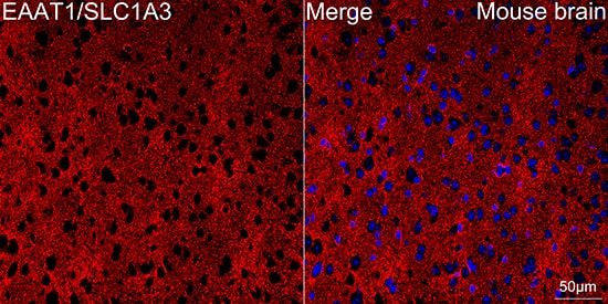 Immunocytochemistry/ Immunofluorescence: EAAT1/GLAST-1/SLC1A3 Antibody (7Y4U5) [NBP3-16865] - Confocal imaging of paraffin-embedded Mouse brain tissue using EAAT1/GLAST-1/SLC1A3 Rabbit mAb followed by a further incubation with Cy3 Goat Anti-Rabbit IgG (H+L) . DAPI was used for nuclear staining (Blue). Objective: 40x. Perform microwave antigen retrieval with 0.01 M citrate buffer (pH 6.0) prior to IF staining.