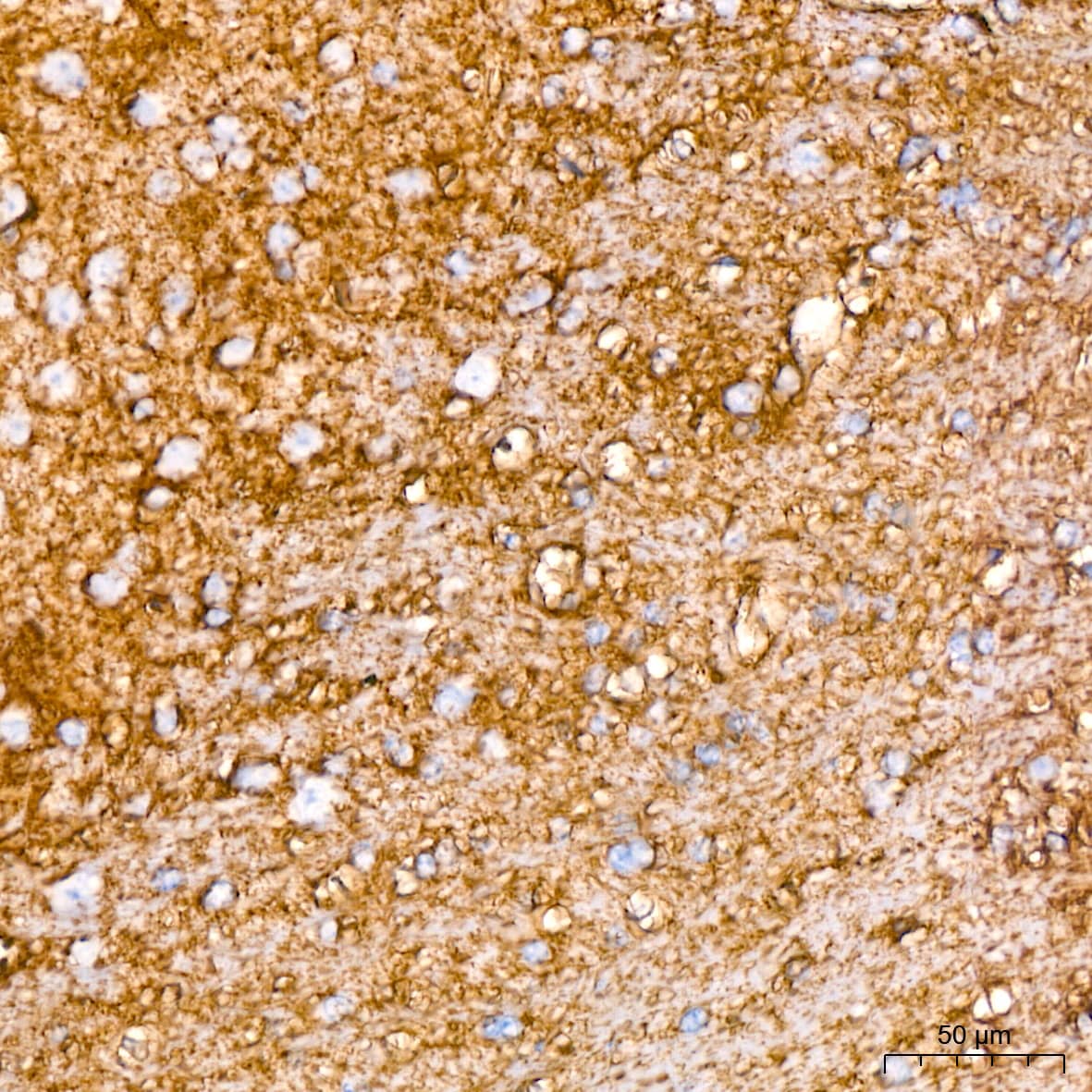 Immunohistochemistry: EAAT1/GLAST-1/SLC1A3 Antibody (7Y4U5) [NBP3-16865] - Immunohistochemistry analysis of paraffin-embedded Mouse brain tissue using EAAT1/GLAST-1/SLC1A3 Rabbit mAb at a dilution of 1:200 (40x lens). High pressure antigen retrieval performed with 0.01M Citrate Bufferr (pH 6.0) prior to IHC staining.