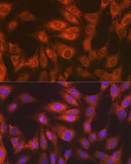 Immunocytochemistry/ Immunofluorescence: eEF-2 Antibody (4E2Z5) [NBP3-16866] - Immunofluorescence analysis of C6 cells using eEF-2 Rabbit mAb at dilution of 1:100 (40x lens). Secondary antibody: Cy3-conjugated Goat anti-Rabbit IgG (H+L) at 1:500 dilution. Blue: DAPI for nuclear staining.