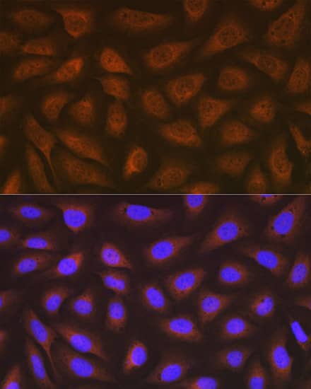 Immunocytochemistry/ Immunofluorescence: eEF-2 Antibody (4E2Z5) [NBP3-16866] - Immunofluorescence analysis of U-2 OS cells using eEF-2 Rabbit mAb at dilution of 1:100 (40x lens). Secondary antibody: Cy3-conjugated Goat anti-Rabbit IgG (H+L) at 1:500 dilution. Blue: DAPI for nuclear staining.