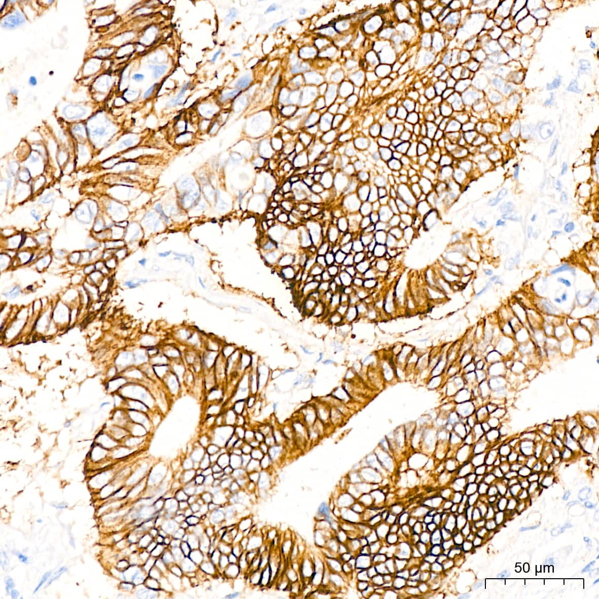 Immunohistochemistry Glutamate Receptor 6 Antibody (4B4L9)