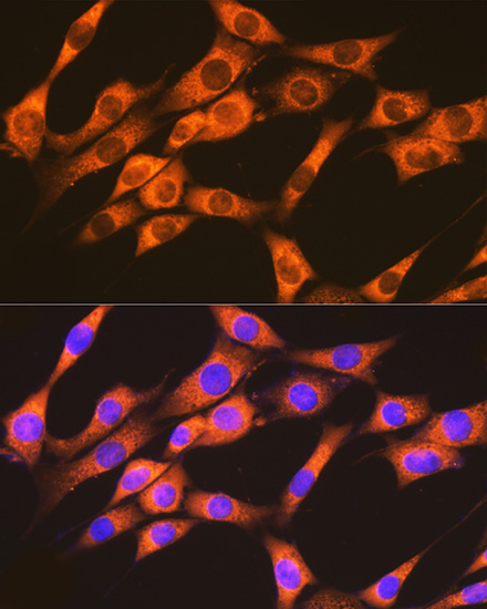 Immunocytochemistry/ Immunofluorescence: Rap1A/B Antibody (6C7G0) [NBP3-16868] - Immunofluorescence analysis of NIH-3T3 cells using Rap1A/B Rabbit mAb at dilution of 1:100 (40x lens). Blue: DAPI for nuclear staining.