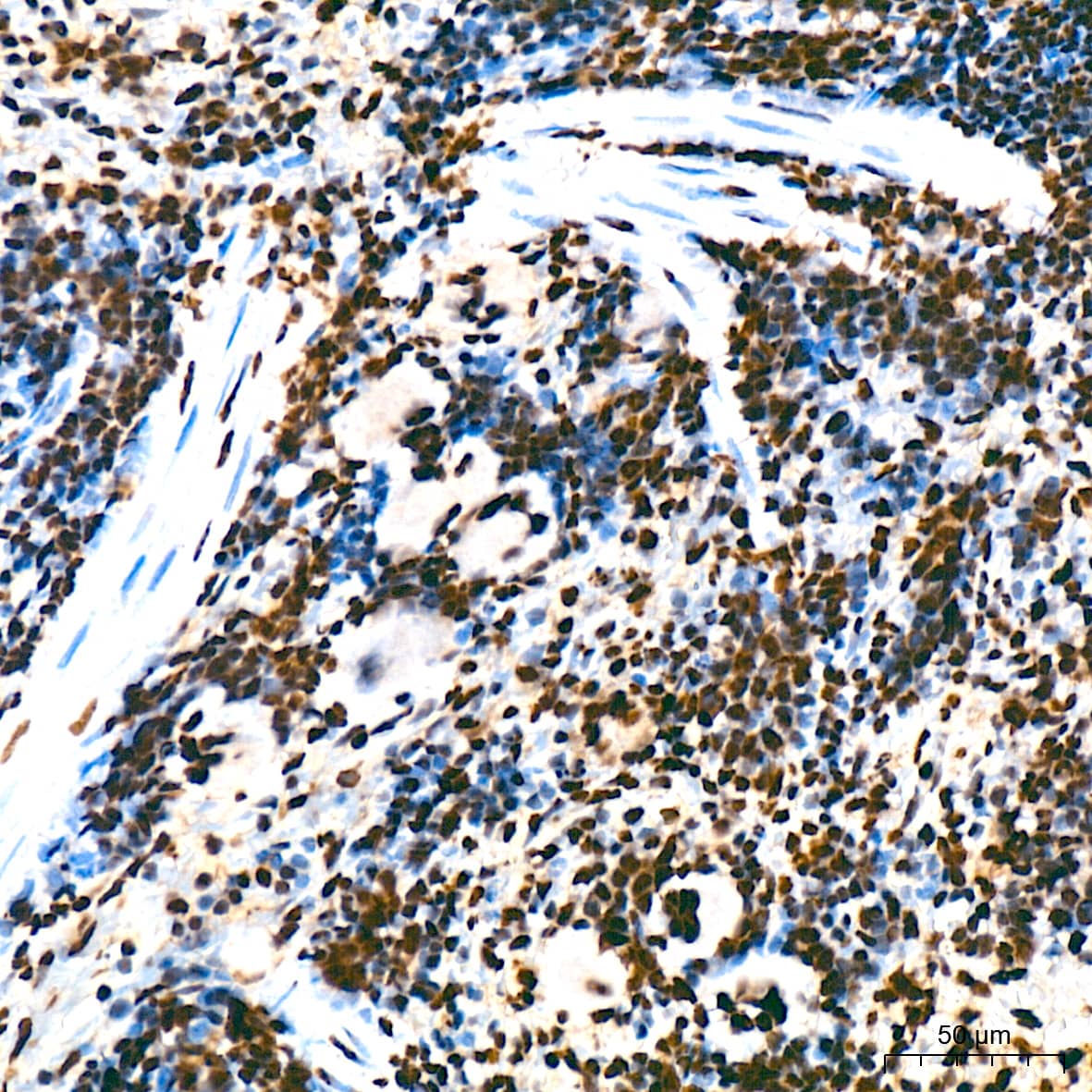 Immunohistochemistry: UAP56 Antibody (4A0Q2) [NBP3-16873] - Immunohistochemistry analysis of UAP56 in paraffin-embedded rat spleen tissue using UAP56 Rabbit mAb  at a dilution of 1:200 (40x lens). High pressure antigen retrieval was performed with 0.01 M citrate buffer (pH 6.0) prior to IHC staining.