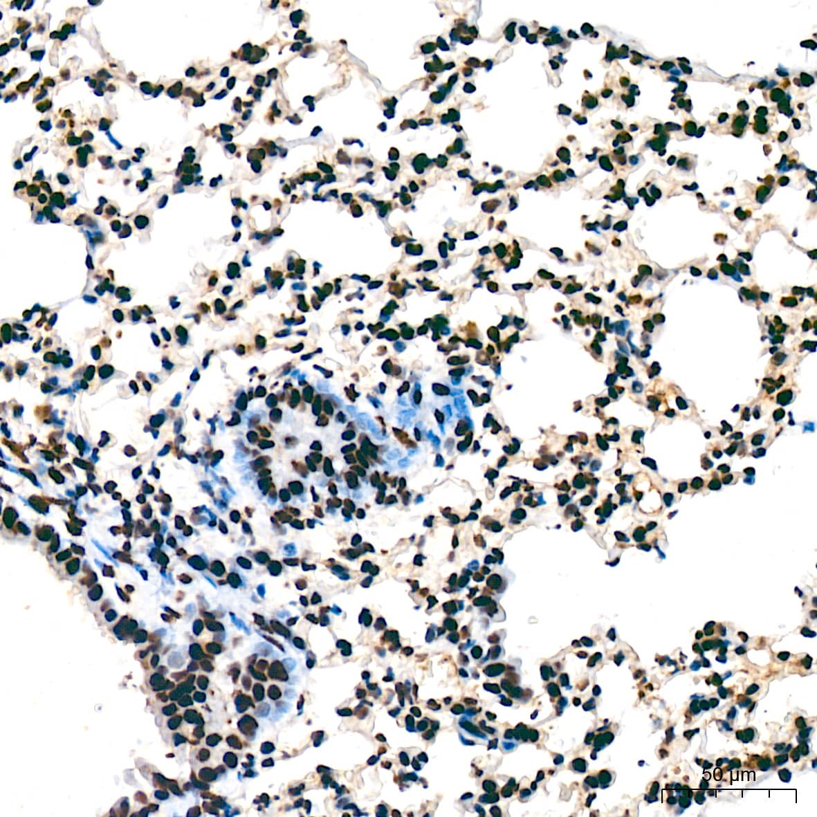 Immunohistochemistry: UAP56 Antibody (4A0Q2) [NBP3-16873] - Immunohistochemistry analysis of UAP56 in paraffin-embedded mouse lung tissue using UAP56 Rabbit mAb  at a dilution of 1:200 (40x lens). High pressure antigen retrieval was performed with 0.01 M citrate buffer (pH 6.0) prior to IHC staining.