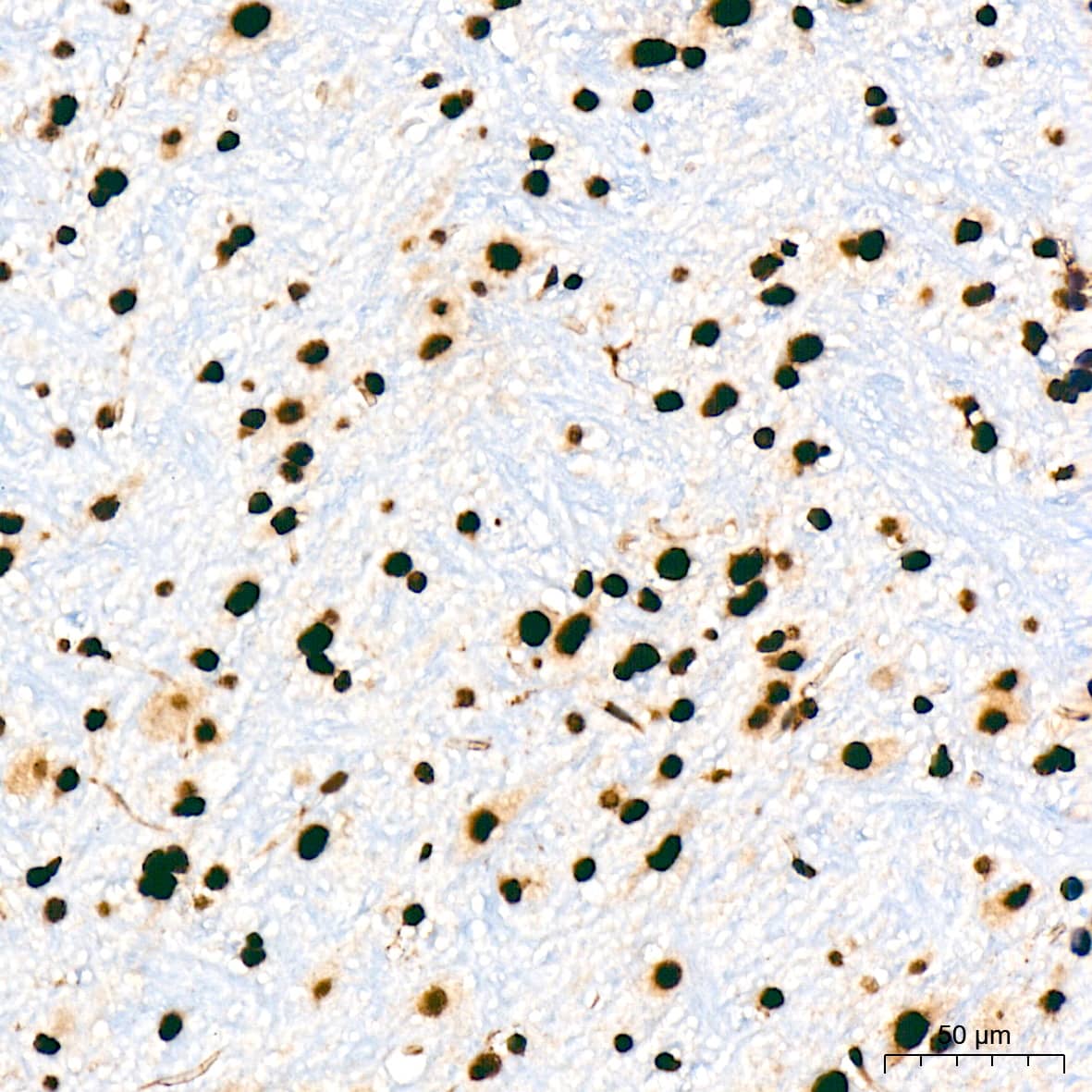 Immunohistochemistry: UAP56 Antibody (4A0Q2) [NBP3-16873] - Immunohistochemistry analysis of UAP56 in paraffin-embedded mouse brain tissue using UAP56 Rabbit mAb  at a dilution of 1:200 (40x lens). High pressure antigen retrieval was performed with 0.01 M citrate buffer (pH 6.0) prior to IHC staining.