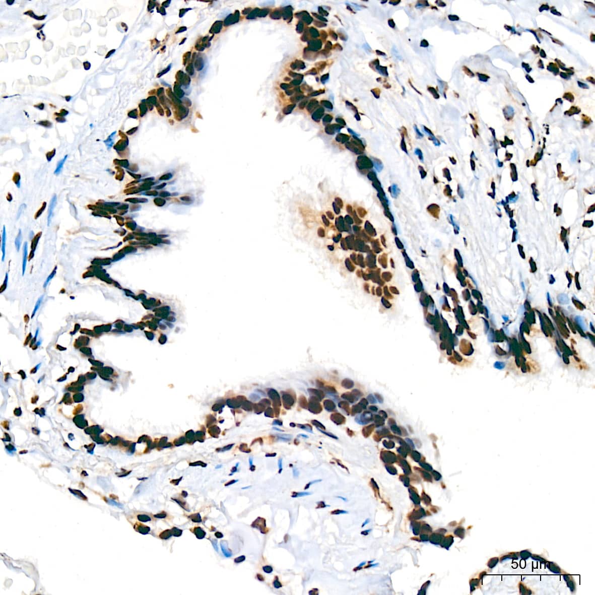 Immunohistochemistry: UAP56 Antibody (4A0Q2) [NBP3-16873] - Immunohistochemistry analysis of UAP56 in paraffin-embedded human lung tissue using UAP56 Rabbit mAb  at a dilution of 1:200 (40x lens). High pressure antigen retrieval was performed with 0.01 M citrate buffer (pH 6.0) prior to IHC staining.