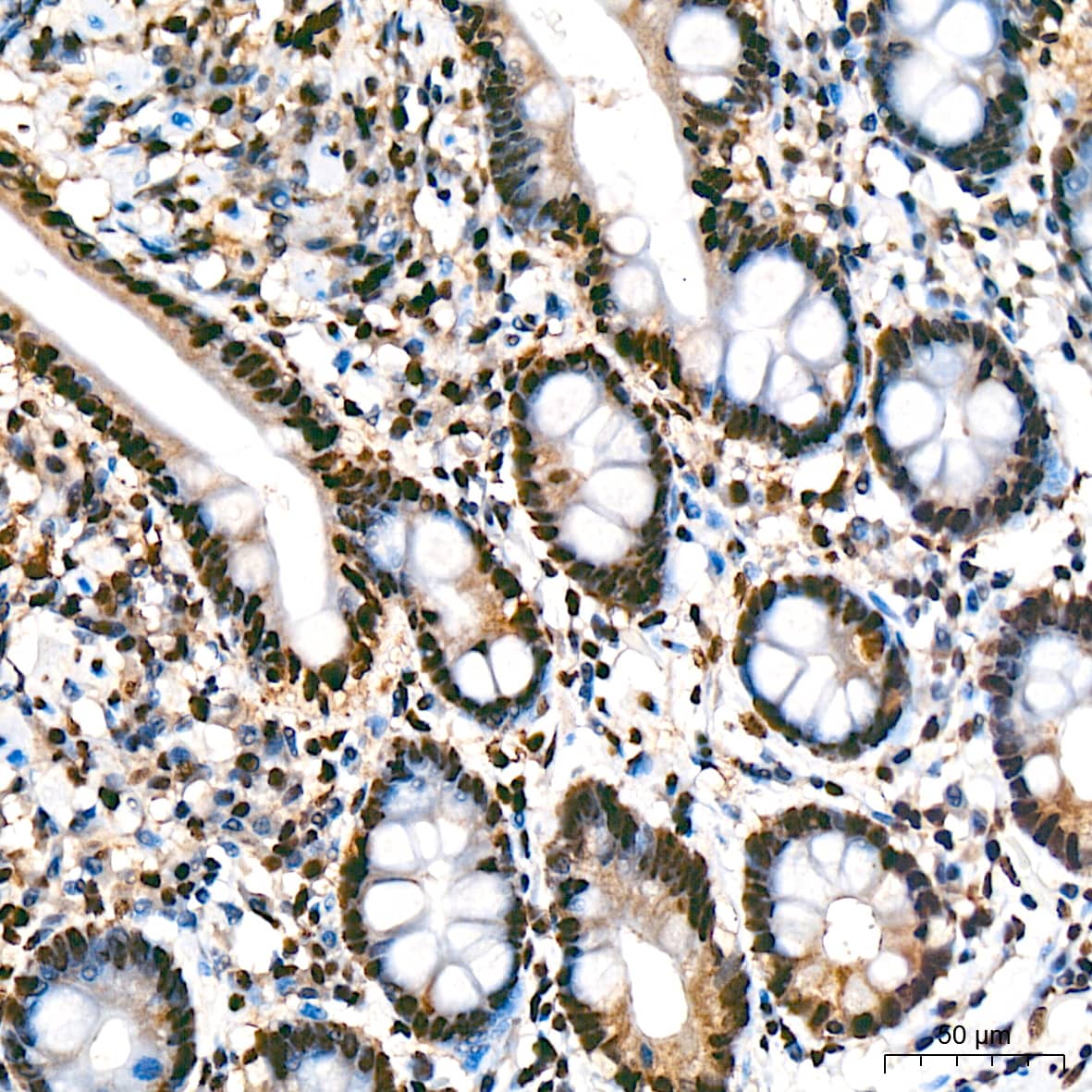 Immunohistochemistry: UAP56 Antibody (4A0Q2) [NBP3-16873] - Immunohistochemistry analysis of UAP56 in paraffin-embedded human colon tissue using UAP56 Rabbit mAb  at a dilution of 1:200 (40x lens). High pressure antigen retrieval was performed with 0.01 M citrate buffer (pH 6.0) prior to IHC staining.