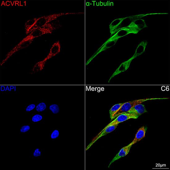 Immunocytochemistry/ Immunofluorescence: ALK-1 Antibody (8L2V7) [NBP3-16876] - Confocal imaging of C6 cells using ALK-1 Rabbit mAb followed by a further incubation with Cy3 Goat Anti-Rabbit IgG (H+L) . The cells were counterstained with alpha-Tubulin Mouse mAb followed by incubation with ABflo(R) 488-conjugated Goat Anti-Mouse IgG (H+L) Ab (Green). DAPI was used for nuclear staining (Blue). Objective: 100x.