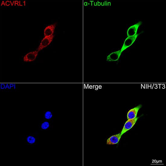Immunocytochemistry/ Immunofluorescence: ALK-1 Antibody (8L2V7) [NBP3-16876] - Confocal imaging of NIH/3T3 cells using ALK-1 Rabbit mAb followed by a further incubation with Cy3 Goat Anti-Rabbit IgG (H+L) . The cells were counterstained with alpha-Tubulin Mouse mAb followed by incubation with ABflo(R) 488-conjugated Goat Anti-Mouse IgG (H+L) Ab (Green). DAPI was used for nuclear staining (Blue). Objective: 100x.