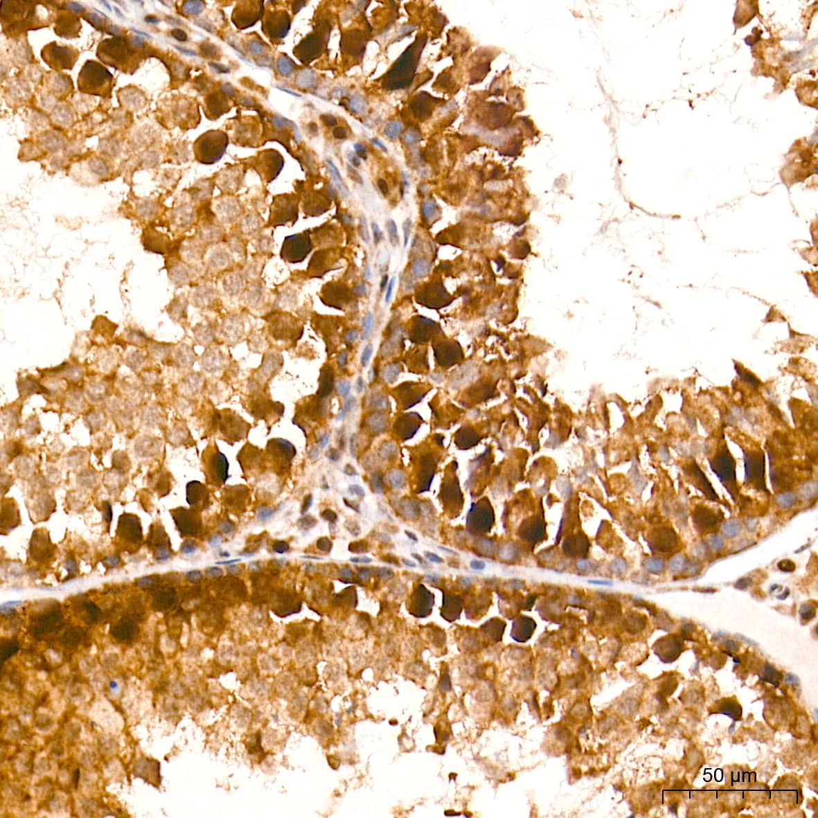 Immunohistochemistry: HES5 Antibody (4S4U7) [NBP3-16880] - Immunohistochemistry analysis of paraffin-embedded Rat testis tissue using HES5 Rabbit mAb at a dilution of 1:500 (40x lens). High pressure antigen retrieval performed with 0.01M Tris-EDTA Buffer (pH 9.0) prior to IHC staining.