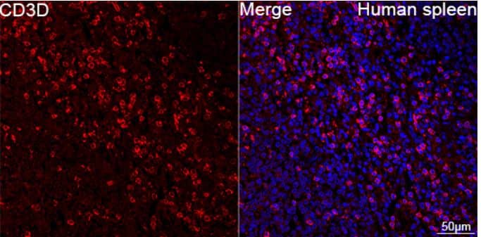 Immunohistochemistry-Paraffin: CD3 delta Antibody (2R1O10) [NBP3-16881] -Confocal imaging of paraffin-embedded Human spleen tissue using CD3D Rabbit mAb (dilution 1:200) followed by a further incubation with Cy3 Goat Anti-Rabbit IgG (H+L) (dilution 1:500) (Red). DAPI was used for nuclear staining (Blue). Objective: 40x. Perform high pressure antigen retrieval with 0.01 M citrate buffer (pH 6.0) prior to IF staining.