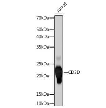 Western Blot: CD3 delta Antibody (2R1O10) [NBP3-16881] -Western blot analysis of extracts of Jurkat cells, using CD3 delta Rabbit mAb (NBP3-16881) at 1:500 dilution. Secondary antibody: HRP Goat Anti-Rabbit IgG (H+L) at 1:10000 dilution. Lysates/proteins: 25ug per lane. Blocking buffer: 3% nonfat dry milk in TBST. Detection: ECL Basic Kit. Exposure time: 60s.