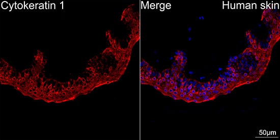 Immunocytochemistry/ Immunofluorescence: Cytokeratin 1 Antibody (10W8J6) [NBP3-16883] - Confocal imaging of paraffin-embedded Human skin using Cytokeratin 1 Rabbit mAb followed by a further incubation with Cy3 Goat Anti-Rabbit IgG (H+L) . DAPI was used for nuclear staining (Blue). Objective: 40x.Perform high pressure antigen retrieval with 0.01M citrate buffer (pH 6.0) prior to IF staining.