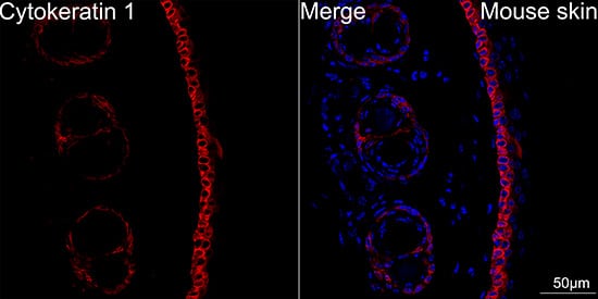 Immunocytochemistry/ Immunofluorescence: Cytokeratin 1 Antibody (10W8J6) [NBP3-16883] - Confocal imaging of paraffin-embedded Mouse skin using Cytokeratin 1 Rabbit mAb followed by a further incubation with Cy3 Goat Anti-Rabbit IgG (H+L) . DAPI was used for nuclear staining (Blue). Objective: 40x.Perform high pressure antigen retrieval with 0.01M citrate buffer (pH 6.0) prior to IF staining.