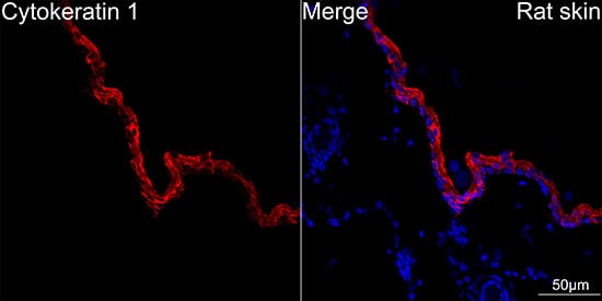 Immunocytochemistry/ Immunofluorescence: Cytokeratin 1 Antibody (10W8J6) [NBP3-16883] - Confocal imaging of paraffin-embedded Rat skin using Cytokeratin 1 Rabbit mAb followed by a further incubation with Cy3 Goat Anti-Rabbit IgG (H+L) . DAPI was used for nuclear staining (Blue). Objective: 40x.Perform high pressure antigen retrieval with 0.01M citrate buffer (pH 6.0) prior to IF staining.