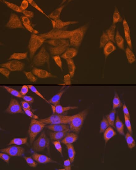 Immunocytochemistry/ Immunofluorescence: USP9x Antibody (7T0S2) [NBP3-16884] - Immunofluorescence analysis of NIH-3T3 cells using USP9x Rabbit mAb at dilution of 1:100 (40x lens). Secondary antibody: Cy3 Goat Anti-Rabbit IgG (H+L) at 1:500 dilution. Blue: DAPI for nuclear staining.