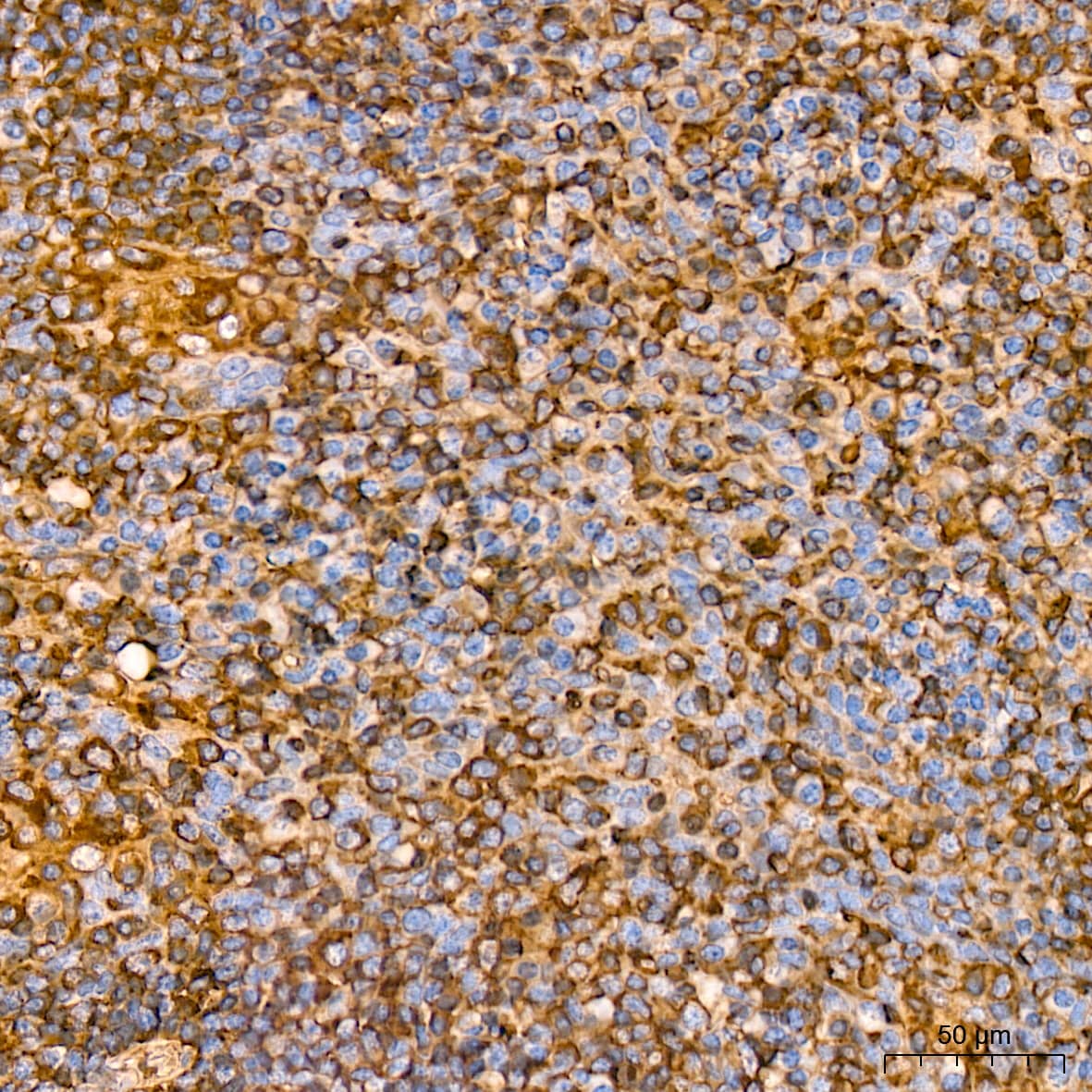 Immunohistochemistry: beta-Actin Antibody (4C4) [NBP3-16886] - Immunohistochemistry analysis of paraffin-embedded Human tonsil tissue using beta-Actin Rabbit mAb at a dilution of 1:400 (40x lens). High pressure antigen retrieval performed with 0.01M Citrate Buffer (pH 6.0) prior to IHC staining.