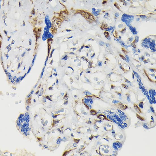 <b>Biological Strategies Validation. </b>Immunohistochemistry: VASP [p Ser239] Antibody - Azide and BSA Free [NBP3-16890] - Immunohistochemistry analysis of paraffin-embedded Human placenta using VASP Rabbit pAb at dilution of 1:100 (40x lens). High pressure antigen retrieval performed with 0.01M Citrate Bufferr (pH 6.0) prior to IHC staining.