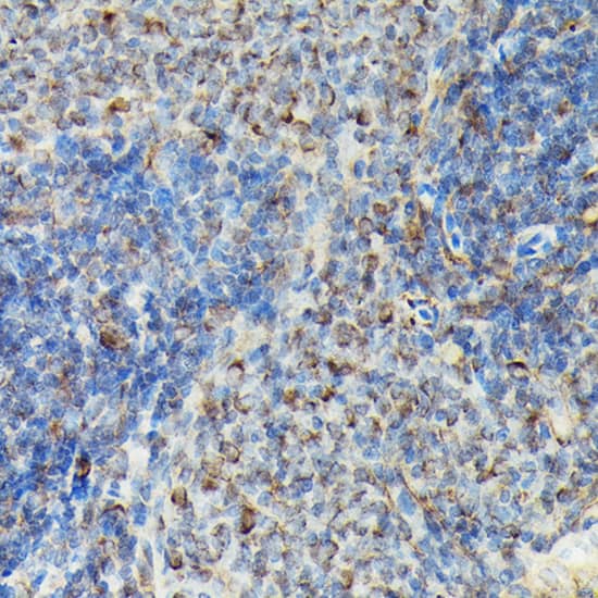 Immunohistochemistry: VASP [p Ser239] Antibody - Azide and BSA Free [NBP3-16890] - Immunohistochemistry analysis of paraffin-embedded Rat spleen using VASP Rabbit pAb at dilution of 1:100 (40x lens). High pressure antigen retrieval performed with 0.01M Citrate Bufferr (pH 6.0) prior to IHC staining.