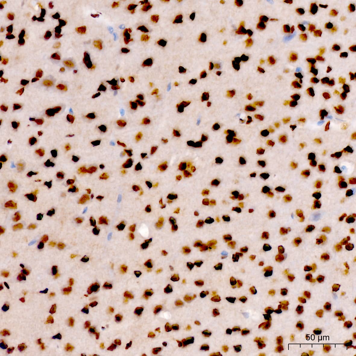 Immunohistochemistry: RNA Polymerase II/POLR2A [p Ser7] Antibody - Azide and BSA Free [NBP3-16906] - Immunohistochemistry analysis of paraffin-embedded Rat brain using RNA Polymerase II/POLR2A Rabbit pAb at dilution of 1:200 (40x lens). High pressure antigen retrieval performed with 0.01M Citrate Bufferr (pH 6.0) prior to IHC staining.