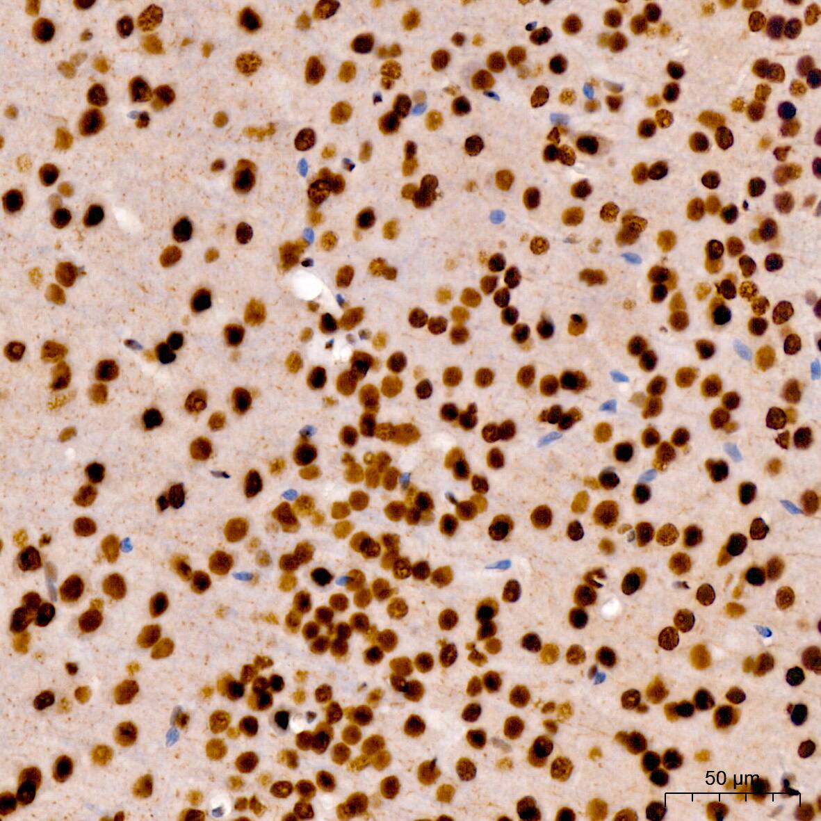 Immunohistochemistry: RNA Polymerase II/POLR2A [p Ser7] Antibody - Azide and BSA Free [RNA Polymerase II/POLR2A] - Immunohistochemistry analysis of paraffin-embedded Mouse brain using RNA Polymerase II/POLR2A Rabbit pAb  at dilution of 1:200 (40x lens). High pressure antigen retrieval performed with 0.01M Citrate Bufferr (pH 6.0) prior to IHC staining.