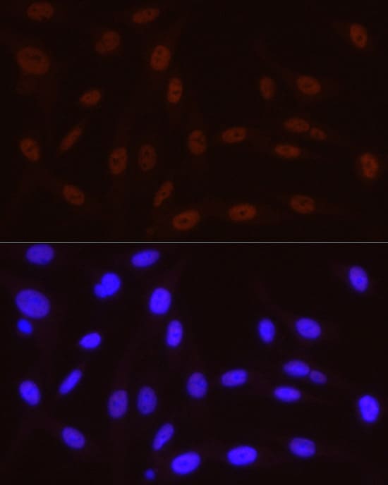 Immunocytochemistry/ Immunofluorescence: RNA Polymerase II/POLR2A [p Ser5] Antibody (10C7U2) [NBP3-16910] - Immunofluorescence analysis of PC-12 cells using RNA Polymerase II/POLR2A Rabbit mAb at dilution of 1:50 (40x lens). Secondary antibody: Cy3-conjugated Goat anti-Rabbit IgG (H+L) at 1:500 dilution. Blue: DAPI for nuclear staining.