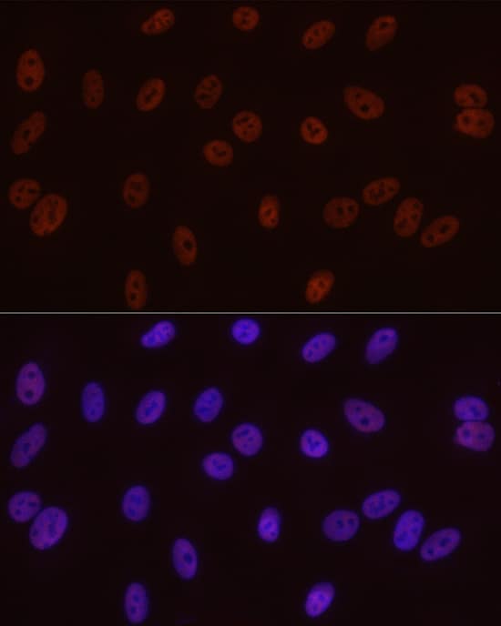 Immunocytochemistry/ Immunofluorescence: RNA Polymerase II/POLR2A [p Ser5] Antibody (10C7U2) [NBP3-16910] - Immunofluorescence analysis of A-549 cells using RNA Polymerase II/POLR2A Rabbit mAb at dilution of 1:50 (40x lens). Secondary antibody: Cy3-conjugated Goat anti-Rabbit IgG (H+L) at 1:500 dilution. Blue: DAPI for nuclear staining.