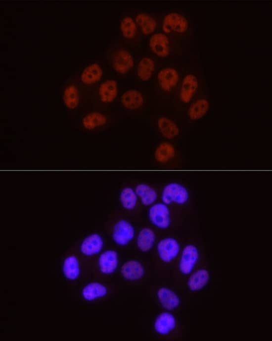 Immunocytochemistry/ Immunofluorescence: RNA Polymerase II/POLR2A [p Ser5] Antibody (10C7U2) [NBP3-16910] - Immunofluorescence analysis of HeLa cells using RNA Polymerase II/POLR2A Rabbit mAb at dilution of 1:50 (40x lens). Secondary antibody: Cy3-conjugated Goat anti-Rabbit IgG (H+L) at 1:500 dilution. Blue: DAPI for nuclear staining.