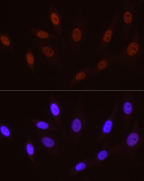 Immunocytochemistry/ Immunofluorescence: RNA Polymerase II/POLR2A [p Ser5] Antibody (10C7U2) [NBP3-16910] - Immunofluorescence analysis of NIH/3T3 cells using RNA Polymerase II/POLR2A Rabbit mAb at dilution of 1:50 (40x lens). Secondary antibody: Cy3-conjugated Goat anti-Rabbit IgG (H+L) at 1:500 dilution. Blue: DAPI for nuclear staining.