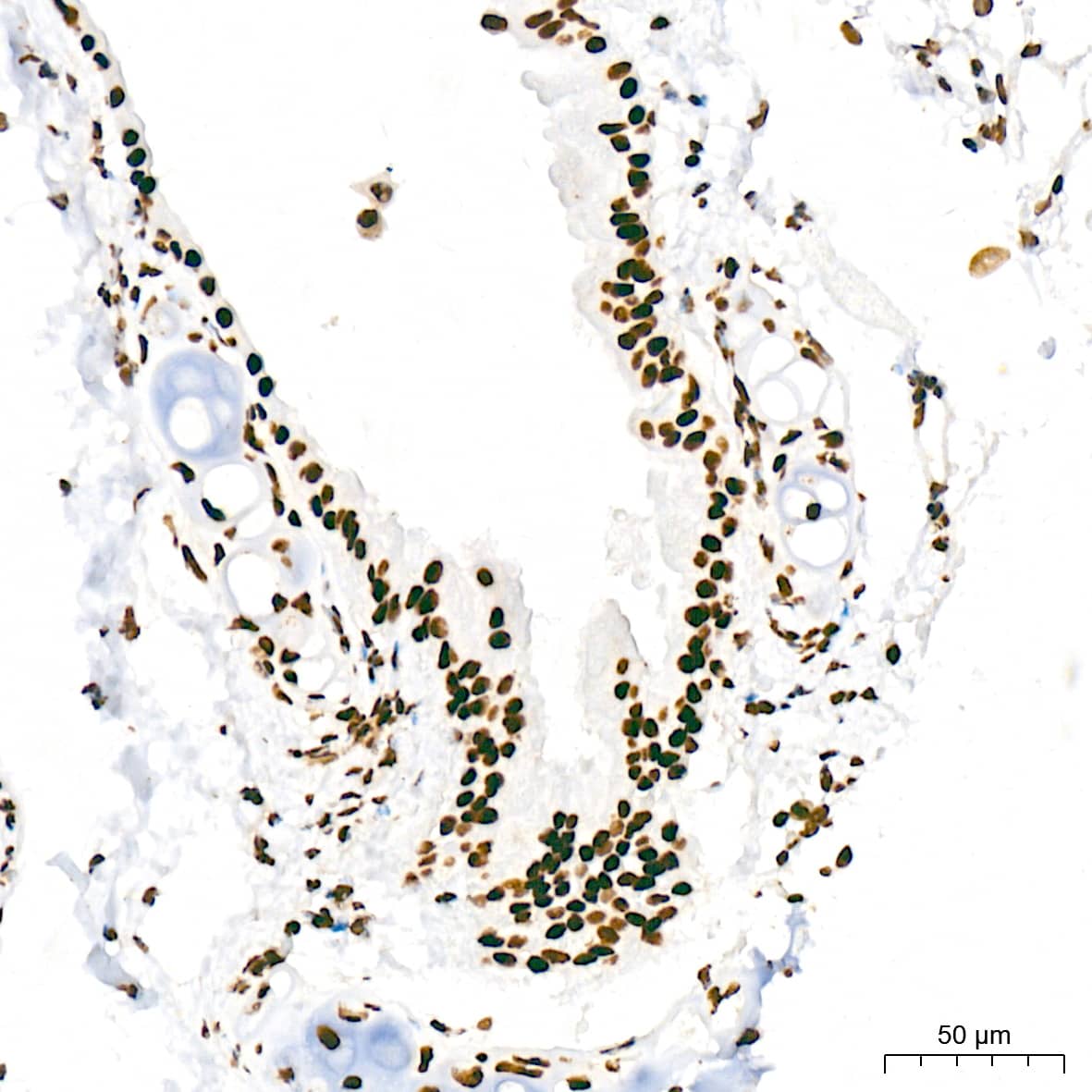 Immunohistochemistry: RNA Polymerase II/POLR2A [p Ser5] Antibody (10C7U2) [NBP3-16910] - Immunohistochemistry analysis of paraffin-embedded Rat lung tissue using RNA Polymerase II/POLR2A Rabbit mAb at a dilution of 1:200 (40x lens). High pressure antigen retrieval was performed with 0.01 M citrate buffer (pH 6.0) prior to IHC staining.