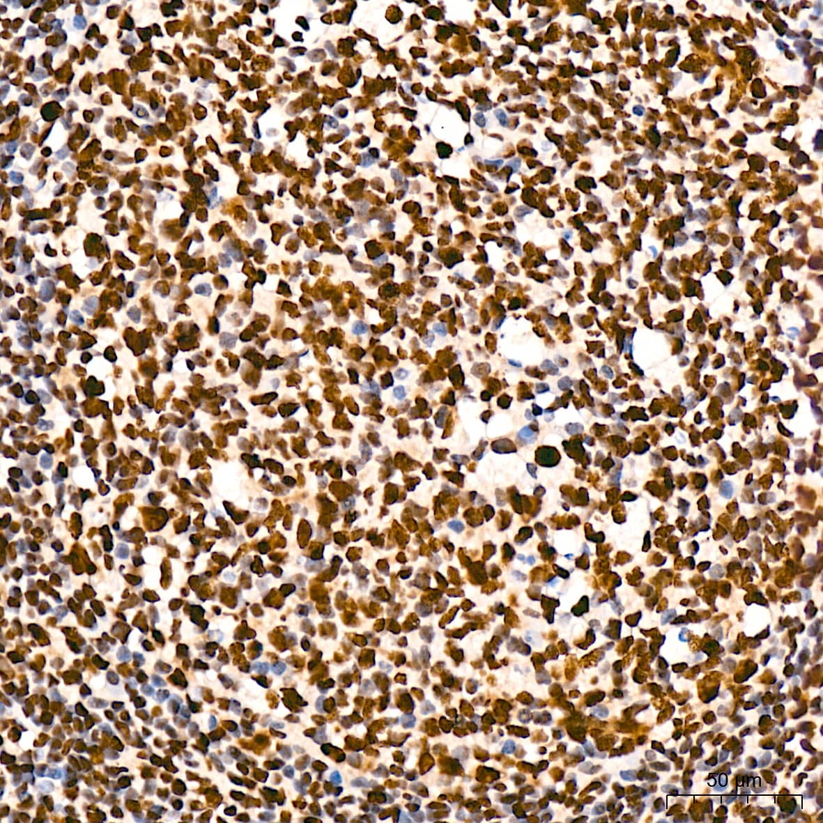 Immunohistochemistry: RNA Polymerase II/POLR2A [p Ser5] Antibody (10C7U2) [NBP3-16910] - Immunohistochemistry analysis of paraffin-embedded Human tonsil tissue using RNA Polymerase II/POLR2A Rabbit mAb at a dilution of 1:200 (40x lens). High pressure antigen retrieval was performed with 0.01 M citrate buffer (pH 6.0) prior to IHC staining.