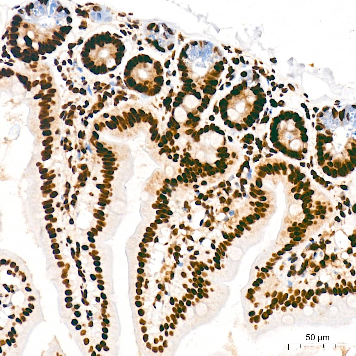 Immunohistochemistry: RNA Polymerase II/POLR2A [p Ser5] Antibody (10C7U2) [NBP3-16910] - Immunohistochemistry analysis of paraffin-embedded Mouse colon tissue using RNA Polymerase II/POLR2A Rabbit mAb at a dilution of 1:200 (40x lens). High pressure antigen retrieval was performed with 0.01 M citrate buffer (pH 6.0) prior to IHC staining.