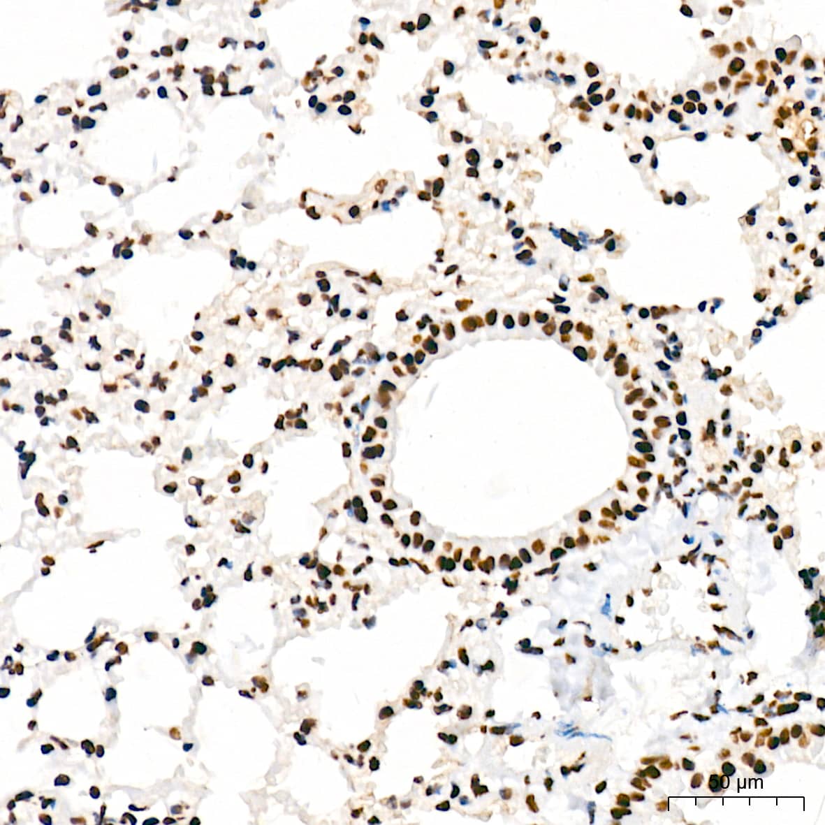 Immunohistochemistry: RNA Polymerase II/POLR2A [p Ser5] Antibody (10C7U2) [NBP3-16910] - Immunohistochemistry analysis of paraffin-embedded Mouse lung tissue using RNA Polymerase II/POLR2A Rabbit mAb at a dilution of 1:200 (40x lens). High pressure antigen retrieval was performed with 0.01 M citrate buffer (pH 6.0) prior to IHC staining.