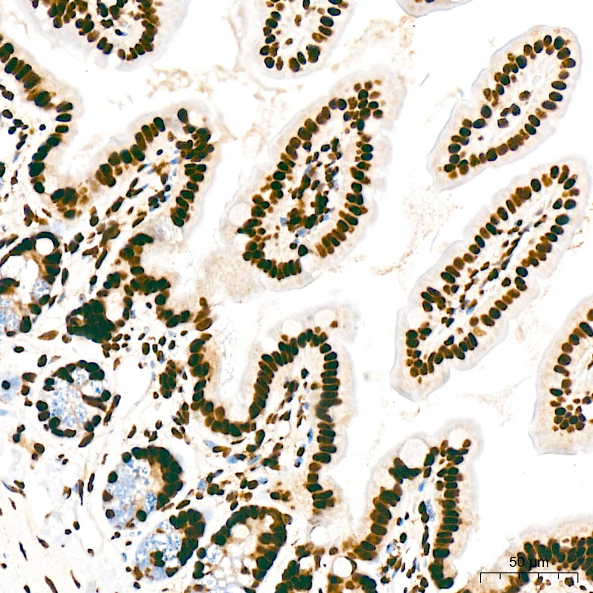 Immunohistochemistry: RNA Polymerase II/POLR2A [p Ser5] Antibody (10C7U2) [NBP3-16910] - Immunohistochemistry analysis of paraffin-embedded Rat intestine tissue using RNA Polymerase II/POLR2A Rabbit mAb at a dilution of 1:200 (40x lens). High pressure antigen retrieval was performed with 0.01 M citrate buffer (pH 6.0) prior to IHC staining.