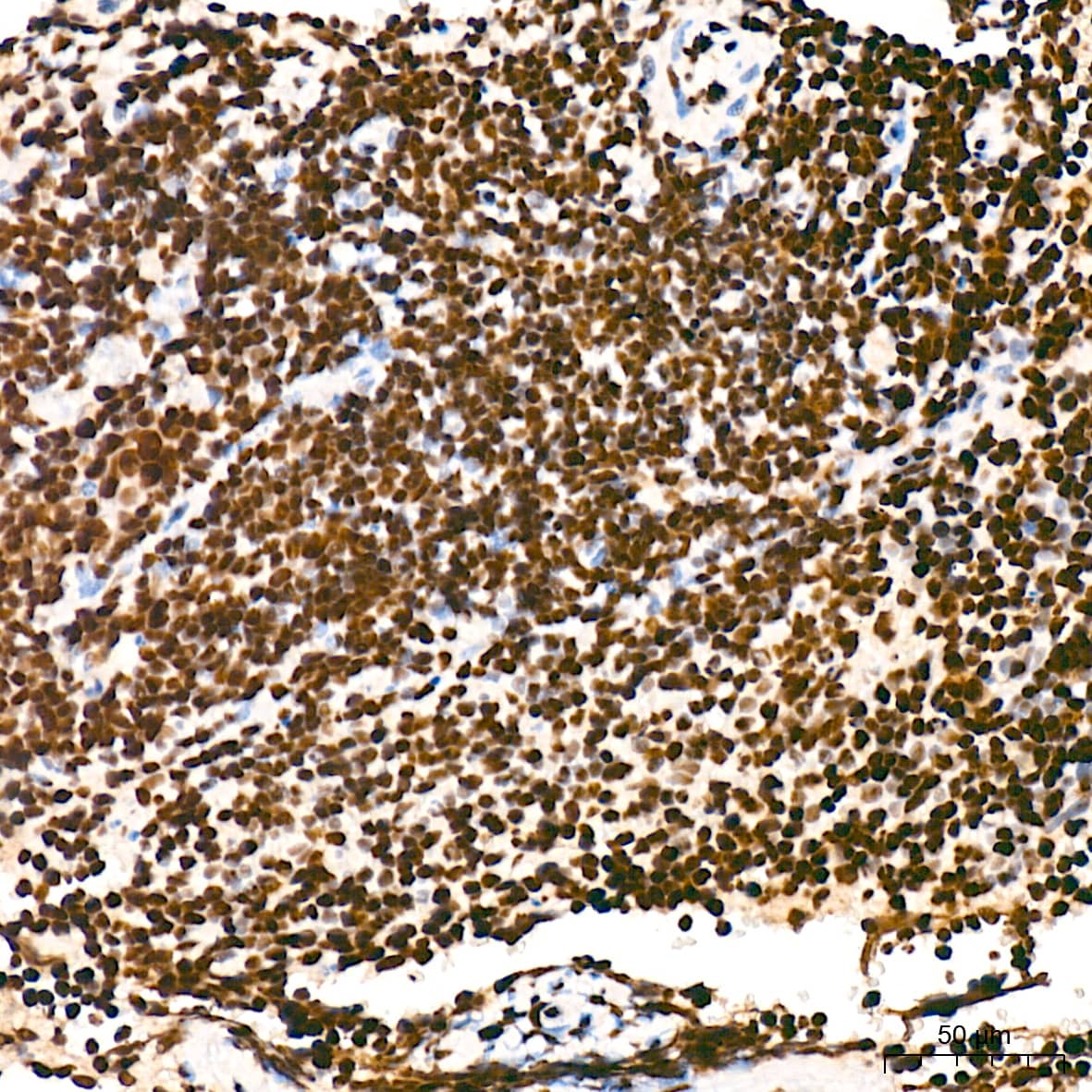 Immunohistochemistry: RNA Polymerase II/POLR2A [p Ser5] Antibody (10C7U2) [NBP3-16910] - Immunohistochemistry analysis of paraffin-embedded Mouse spleen tissue using RNA Polymerase II/POLR2A Rabbit mAb at a dilution of 1:200 (40x lens). High pressure antigen retrieval was performed with 0.01 M citrate buffer (pH 6.0) prior to IHC staining.