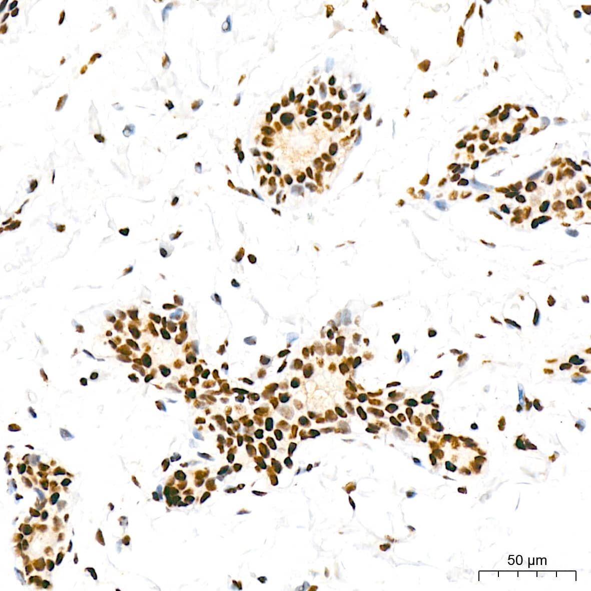 Immunohistochemistry: RNA Polymerase II/POLR2A [p Ser5] Antibody (10C7U2) [NBP3-16910] - Immunohistochemistry analysis of paraffin-embedded Human breast tissue using RNA Polymerase II/POLR2A Rabbit mAb at a dilution of 1:200 (40x lens). High pressure antigen retrieval was performed with 0.01 M citrate buffer (pH 6.0) prior to IHC staining.